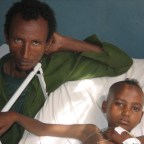 Development of the SOSAS survey, a population based assessment of surgical need. #globalsurgery #globalhealth